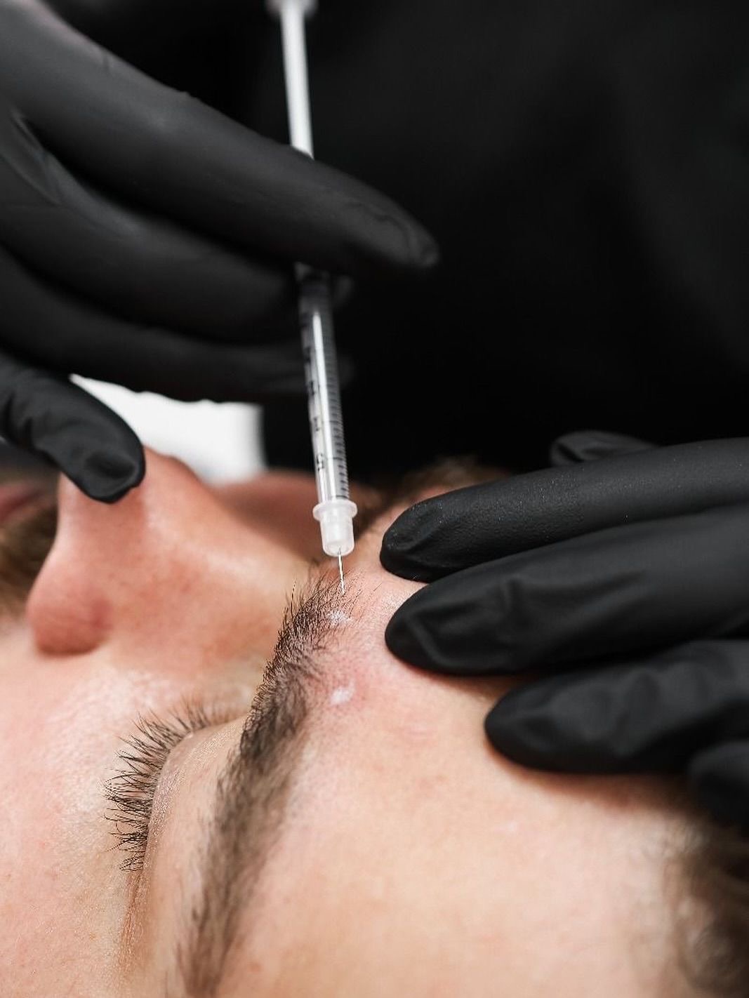 Botox in Palm Beach Gardens, FL